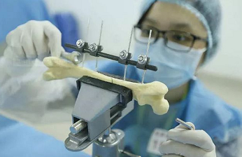 DIC应变视觉测量技术应用于知名学府骨科材料力学科研